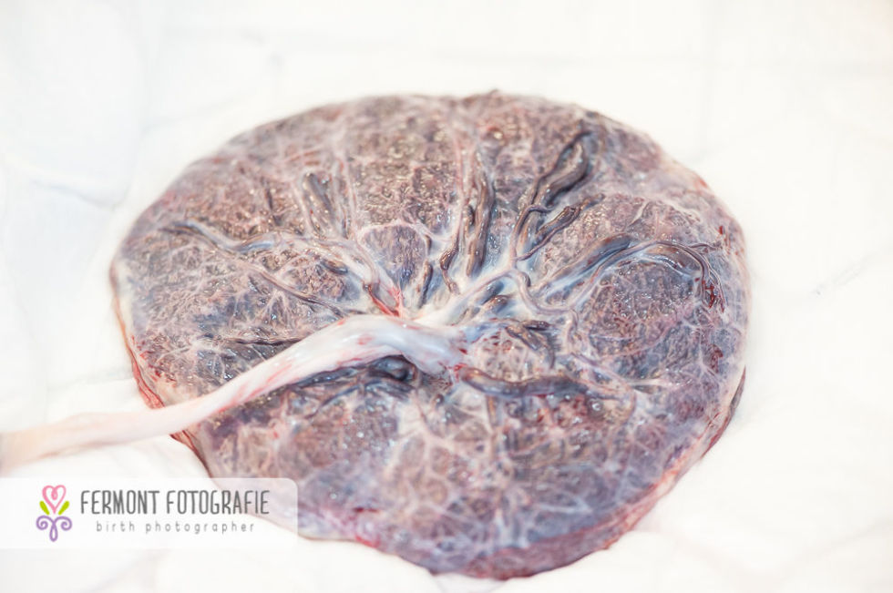 9 Raw Placenta Photos That Highlight the Organ's Beauty